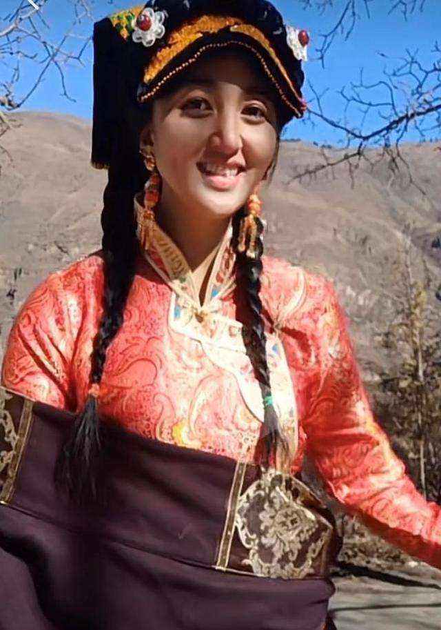 网红拉姆被前夫烧伤不治明日将火化